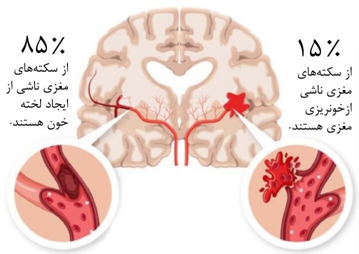 مغز